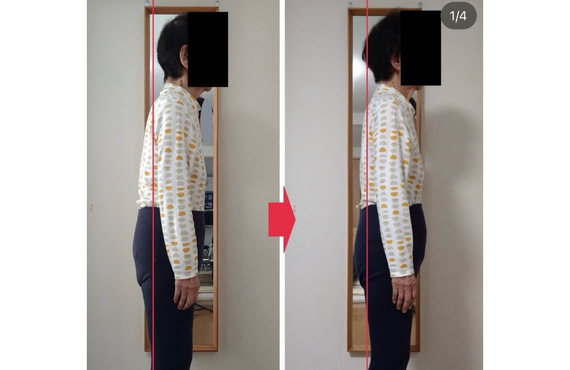 ストレートネックは筋膜リリースが必要 | 八王子のカイロプラクティックなら医院KAORItheChiro