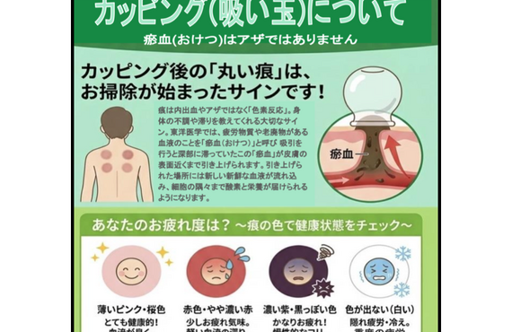 肩こりの原因はファシアの引きつり | 八王子のカイロプラクティックなら医院KAORItheChiro