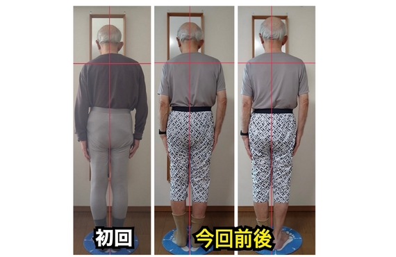 猫背、腰痛の原因は前面からの引きつり｜日野八王子ならKAORItheChiro