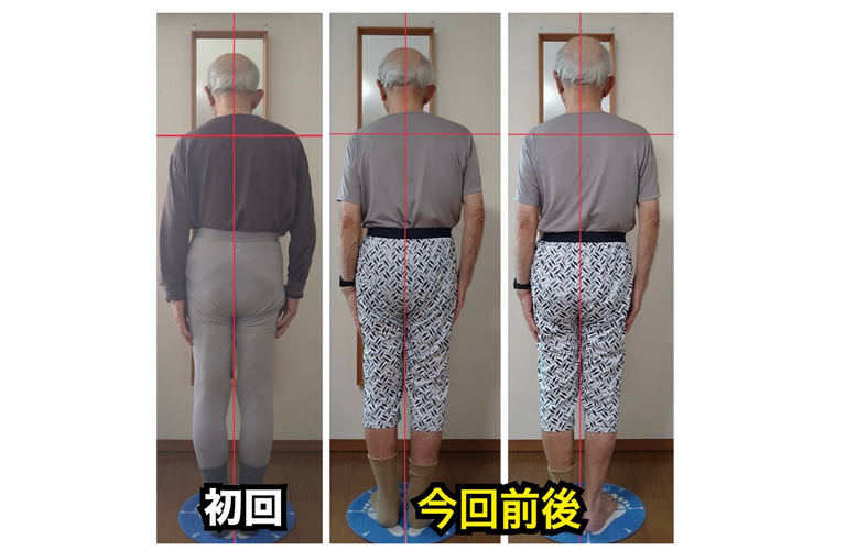 猫背の原因は前面からの引きつり｜KAORItheChiro