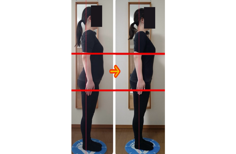 慢性的な腰の重だるさ・反り腰へファシアアプローチ｜日野・八王子近郊ならKAORIthechiro