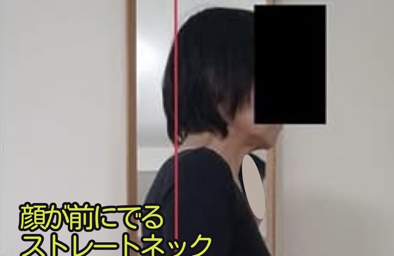 ストレートネック・首こりの本質─首を揉む前に整えるべき「胸郭」と前側ファシアの緊張|筋膜リリースならKAORItheChiro