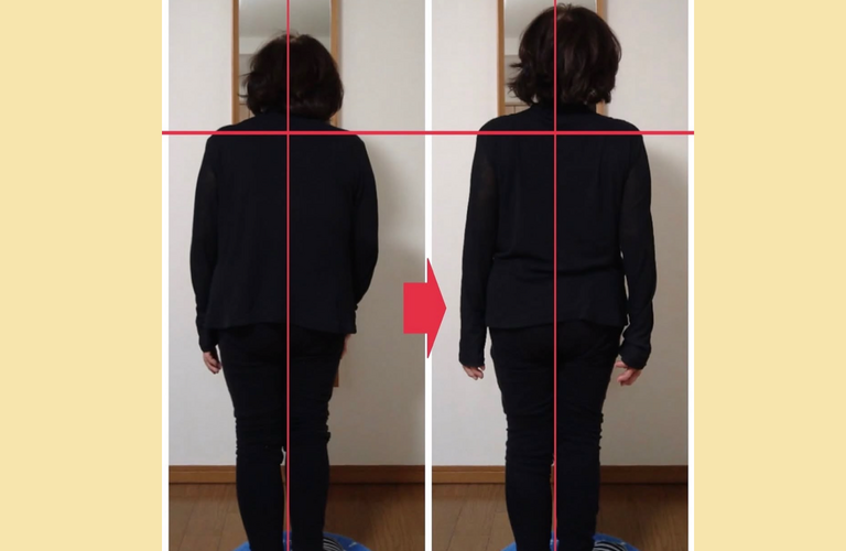 人工関節の手術を受けられた方へ─手術後の「全身の重だるさ・強張り」を解く｜日野八王子ならKAORItheChiro