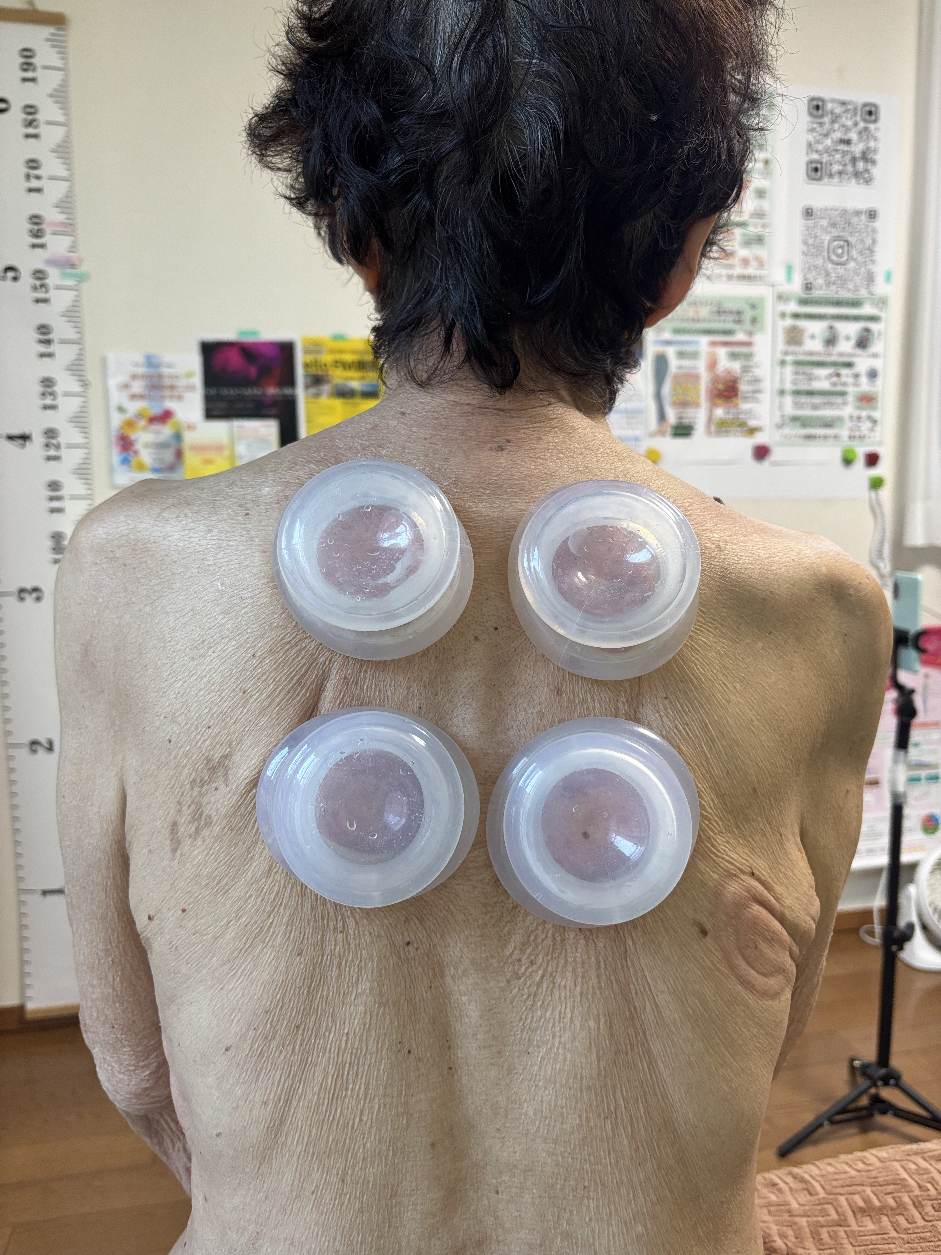 ダウンロード