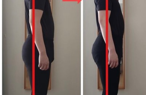 日野・八王子で腰痛改善のカイロプラクティック・整体KAORItheChiro｜カッピングとリンパの構造的ケア
