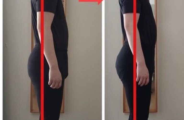 日野・八王子で腰痛改善のカイロプラクティック・整体KAORItheChiro｜カッピングとリンパの構造的ケア